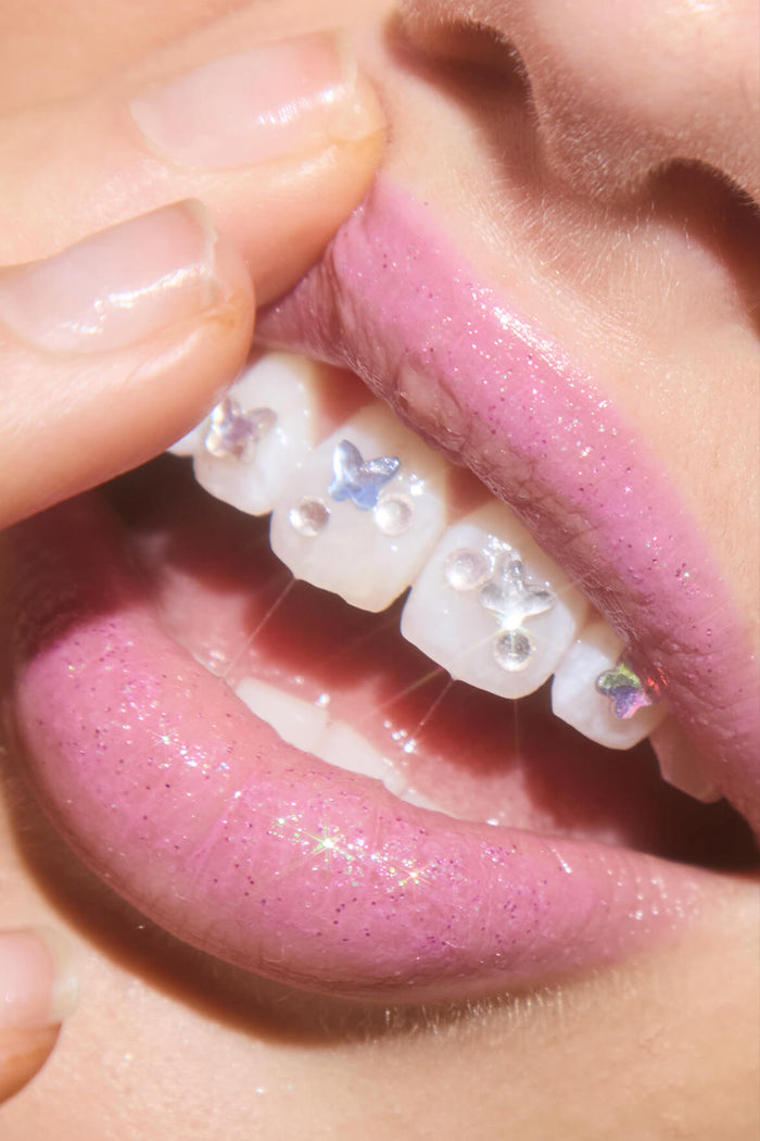 Pink glitter lips with sparkling butterfly and round tooth gems on white teeth.